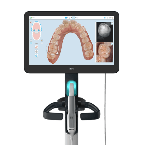 iTero - Invisalign